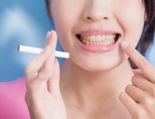 How Smoking Affects Teeth?